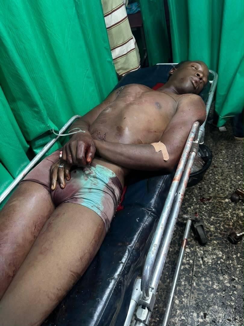 One Killed, Two Injured in Sara-Suka Rival Gang Clash…