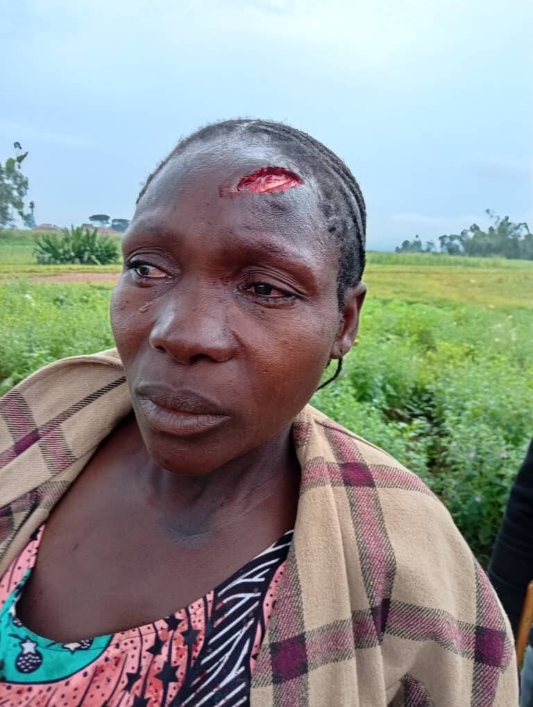 Farmer injured in alleged attack by herders in Bokkos