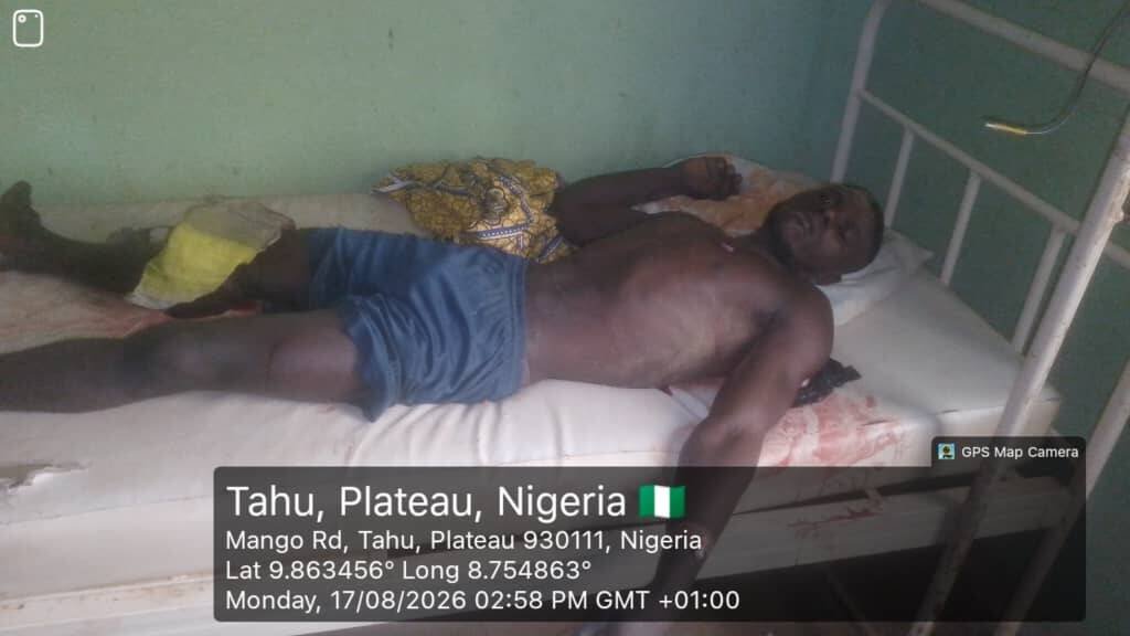 Troops Rescue Gunshot Victim After Fulani Bandits…