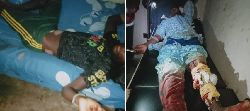 Suspected Mhwaghavul militia attack three cattle herders…