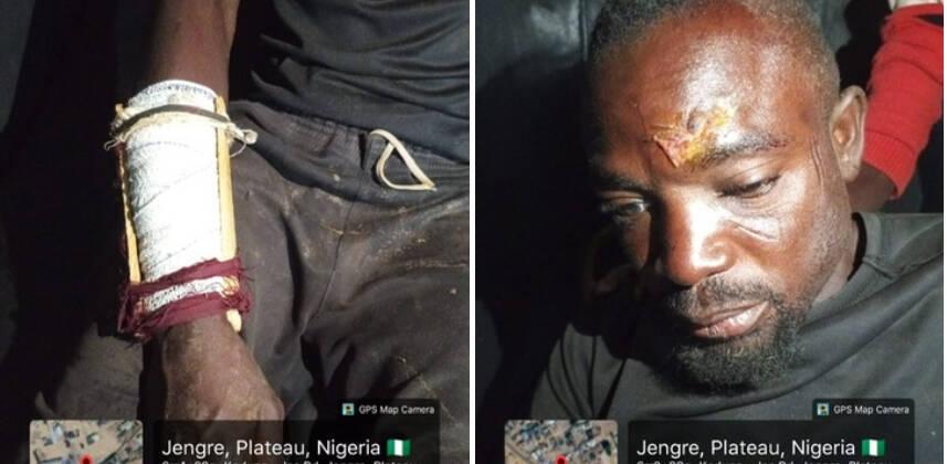Farmer Injured in Machete Attack Allegedly by Herdsmen…