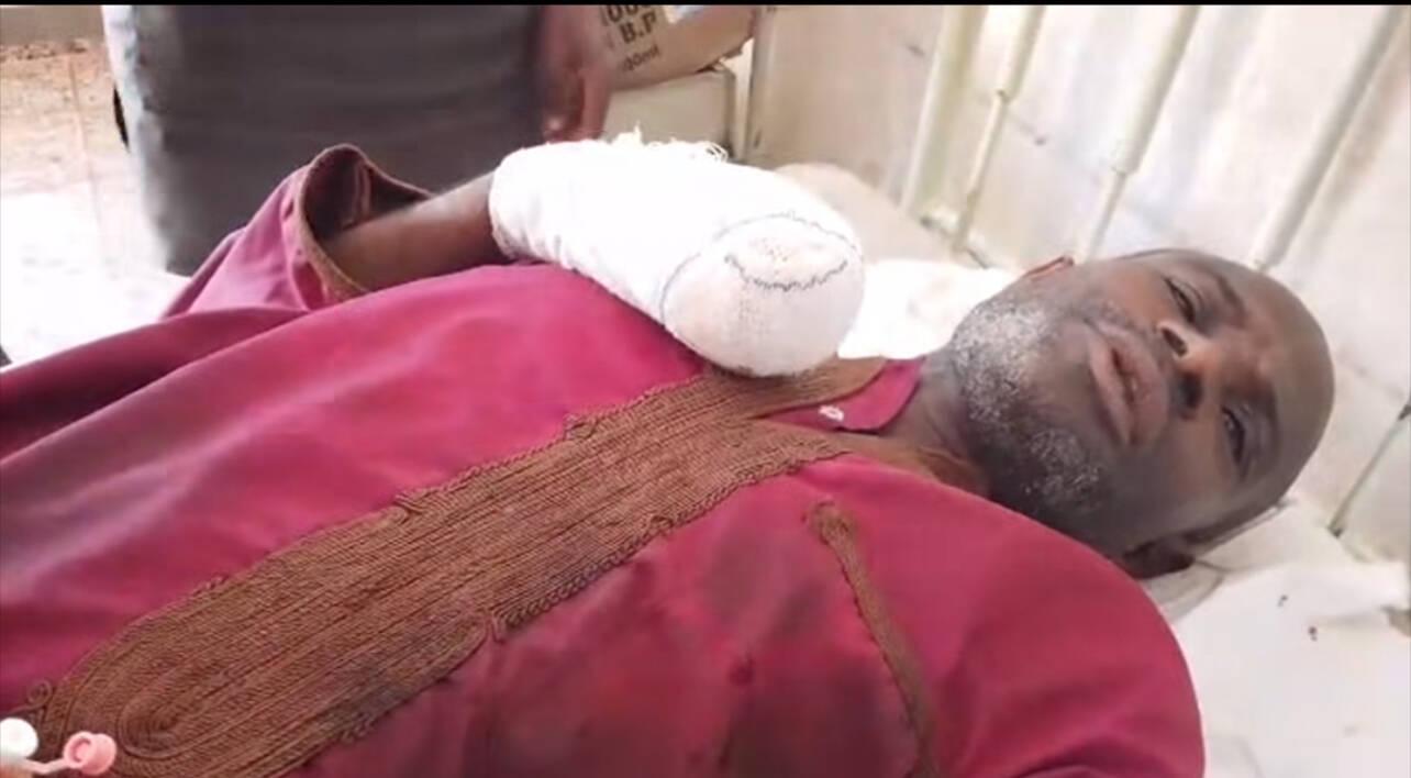 Fulani Man Shot in Plateau Berom Militia Attack Succumbs…
