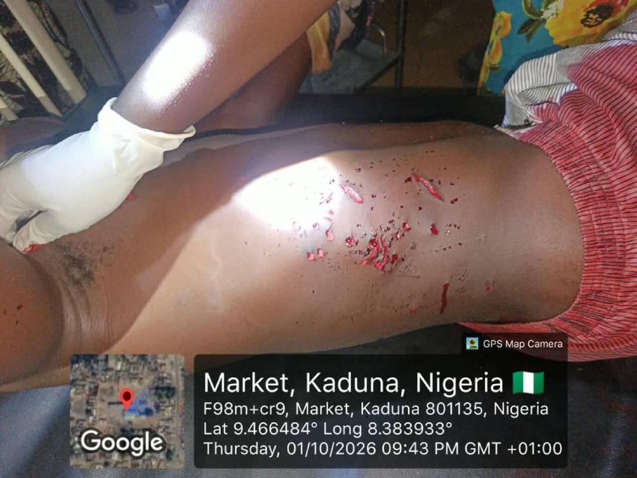 Troops Foil Fulani Bandits Kidnap Attempt, Rescue Gunshot-Wounded…