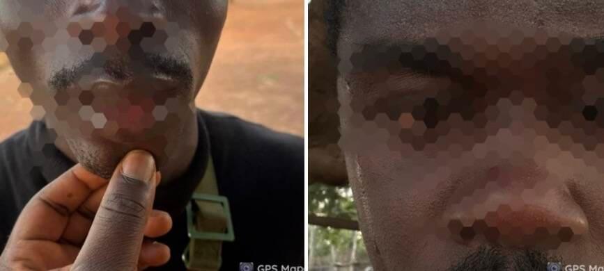 OPEP Arrests Driver for Assaulting Soldier, Area Commander…