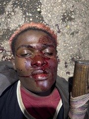 From Fulani Bandits to Berom Militia:&hellip;